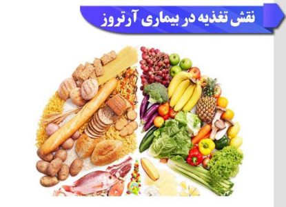 غذاهای مضر برای آرتروز؛ چی آرتروز رو بدتر میکنه؟