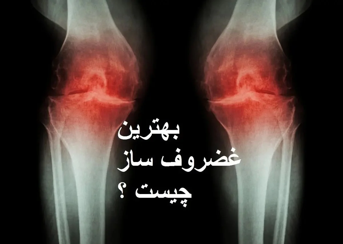 بهترین قرص غضروف ساز خارجی و ایرانی 