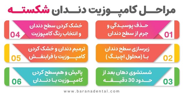 درمان کامپوزیت دندان شکسته ، از مراحل تا پروسه درمان