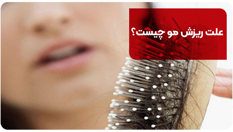 علت ریزش مو چیست؟
