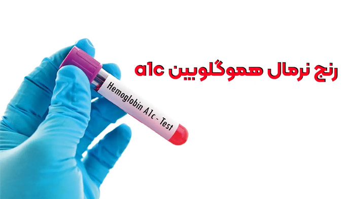 رنج نرمال آهن خون چقدر است؟