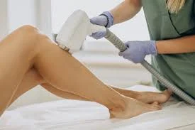 مراحل لیزر موهای زائد چگونه است؟